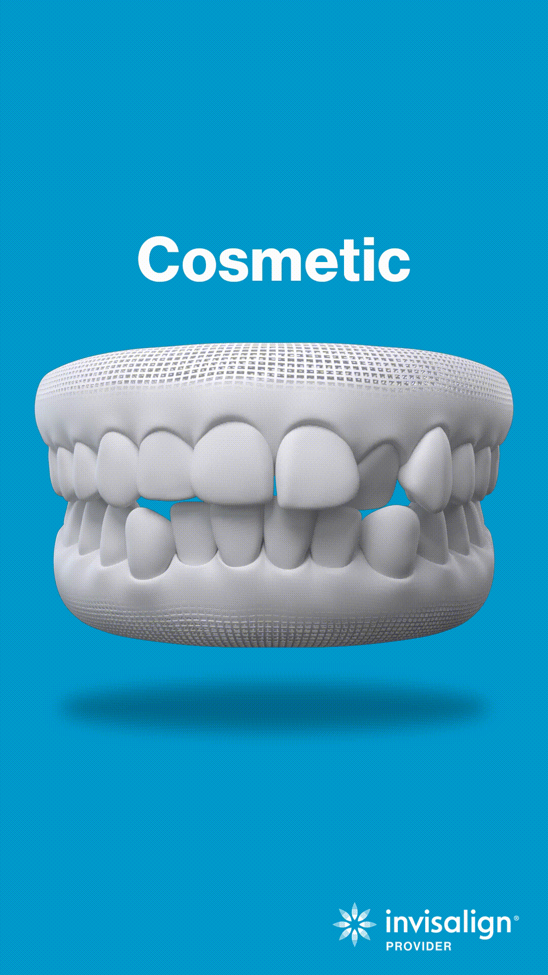 Cosmetic dental model showing teeth alignment on blue background for orthodontics.