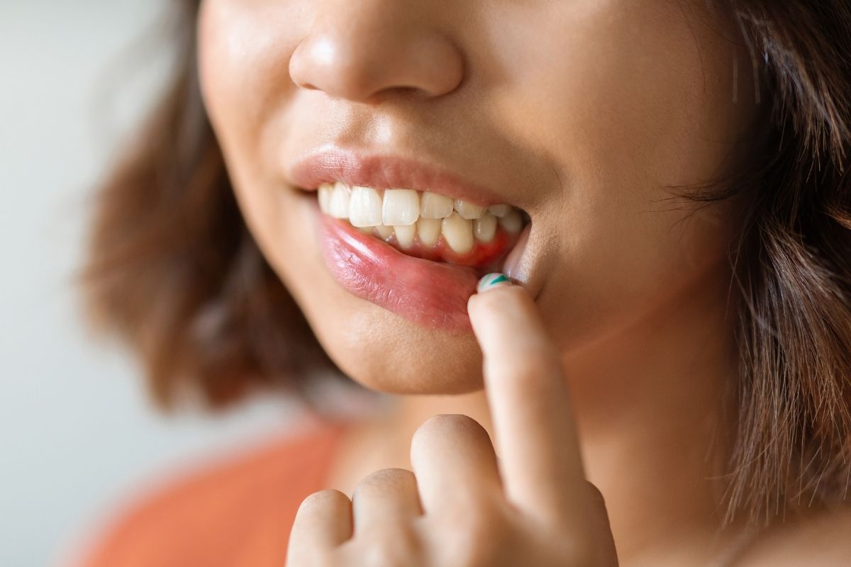 When Lip or Tongue Biting May Signal an Orthodontic Problem