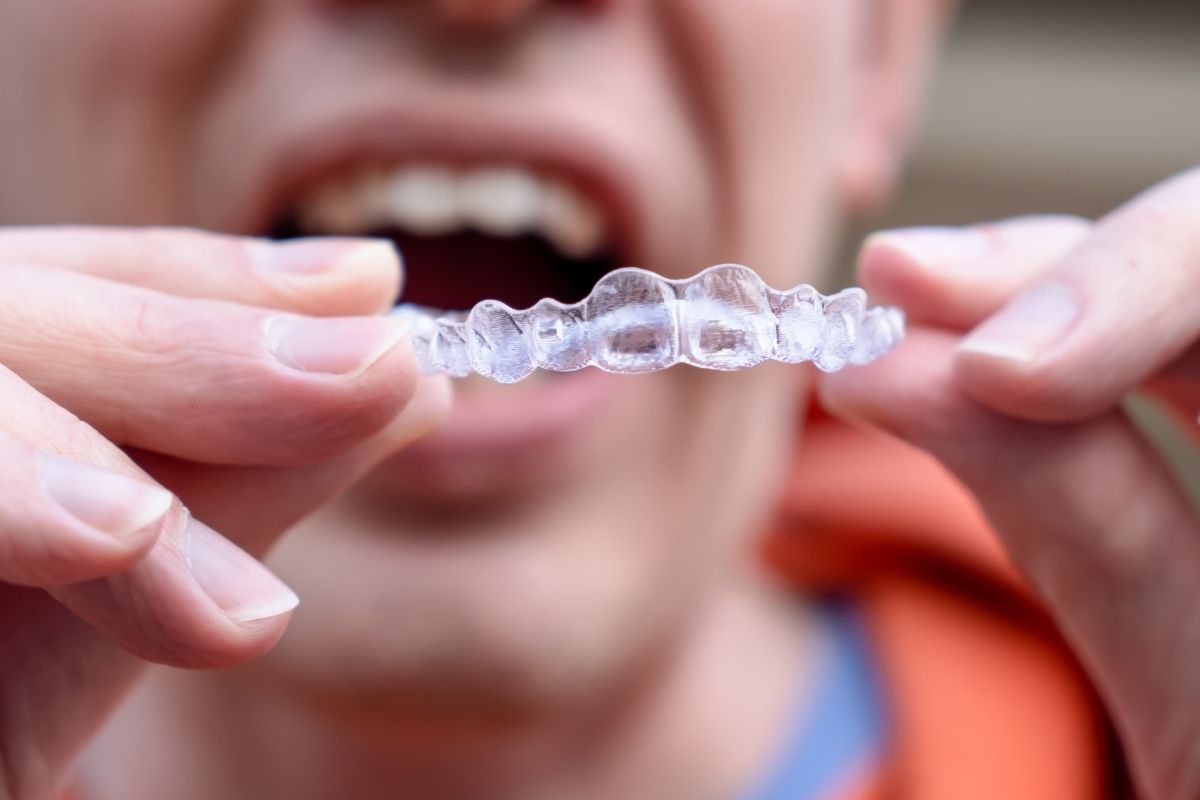Reasons Patients Choose Invisalign Treatment